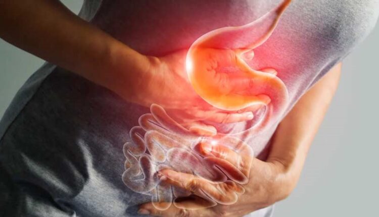 Mide Yanması olan Kişi Ne Yememeli?